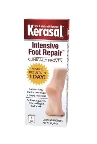 Treatment for extremely dry cracked feet hotsell