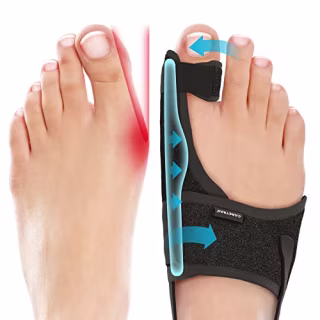 Caretras Bunion Corrector