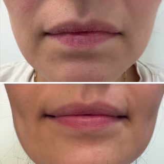 Revision Skincare YouthFull Lip Replenisher