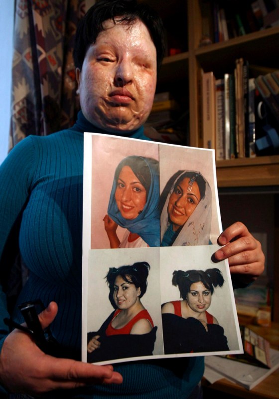 Image: Ameneh Bahrami