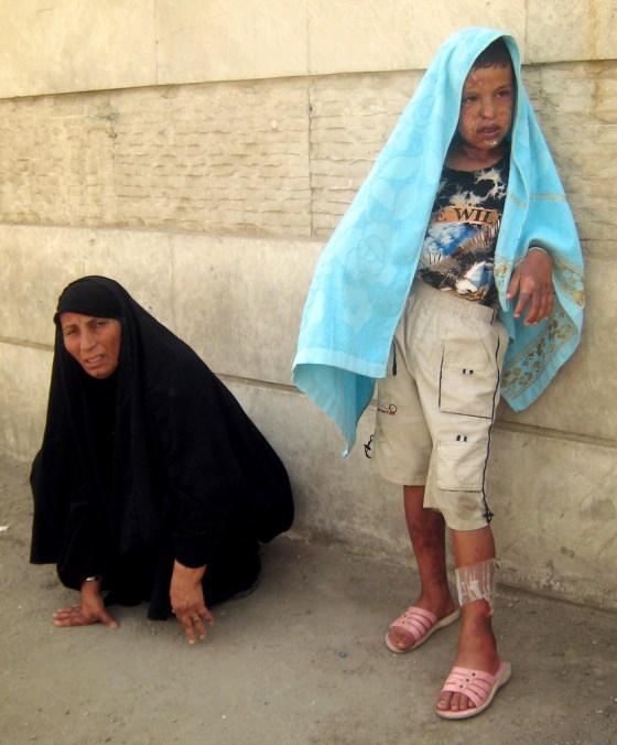 Image: boy wounded by bomb blast in baghdad