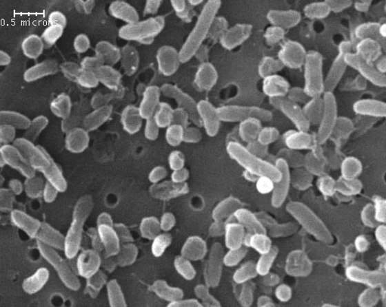 This electron micrograph shows cells of the recently revived bacteria, Herminiimonas glaciei.