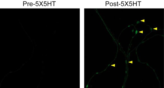 The increase in green fluorescence, right, shows the imaging of protein synthesis at synapses when memories are made.