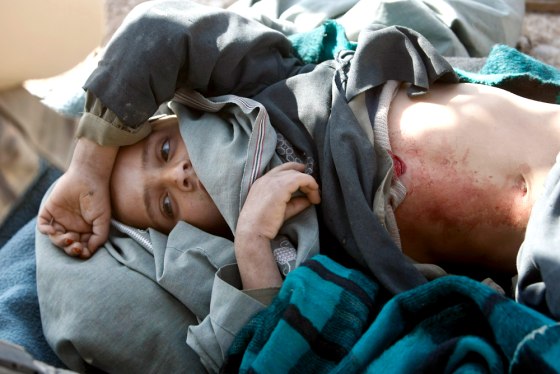 Image:Afghan boy Sayd Rahman, 7, who was shot in crossfire near the Taliban stronghold of Marjah, lies on a stretcher at a U.S. Army outpost