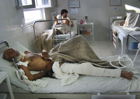 Image: An Afghan man recuperates from his injuries