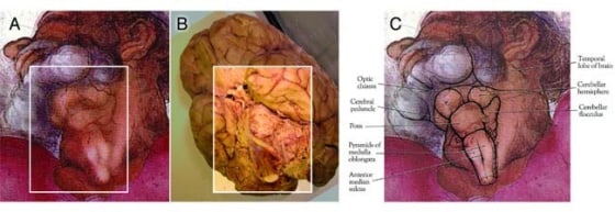 Image: Pictures of brain and Michelangelo's depiction of God's throat