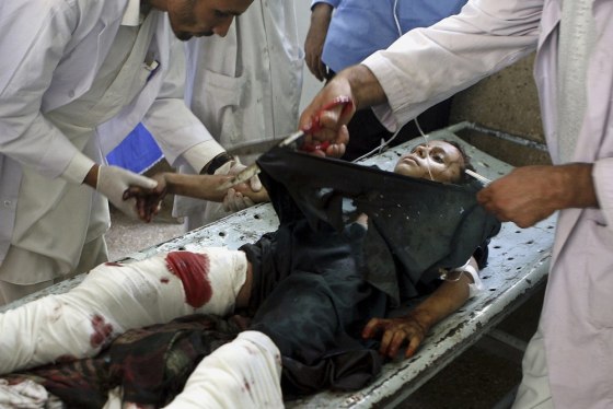 Image: Afghan boy who was wounded after a rocket attack in Kunar province is being treated at a hospital in Jalalabad