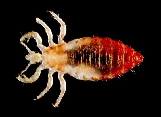 Image: Body louse