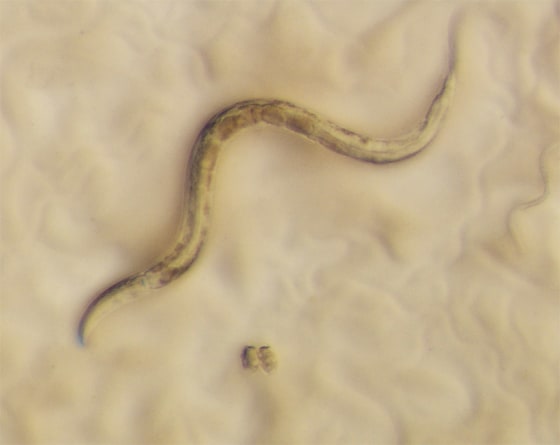 Image: C. elegans, microscopic worm