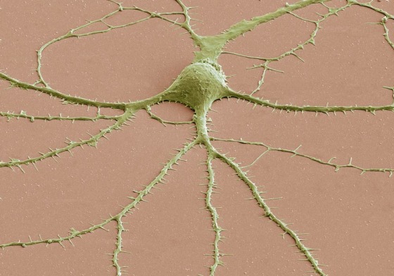 Most neurons have three parts: an axon, a cell body called a soma and dendrites. This scanning electron microscope (SEM) image shows a soma with dendrites (and their spines) radiating from it. To create SEM images, a beam of electrons is scanned across the surface of a sample, and a detector keeps track of electrons bouncing off its surface to reveal the specimen's outer shape.