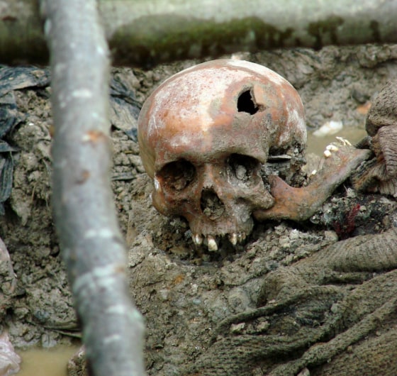 The skull of a victim of the 1995 genocide at Srebrenica. This photo was taken in 2007 at a mass grave exhumed outside of the village of Potocari in Bosnia and Herzegovina.