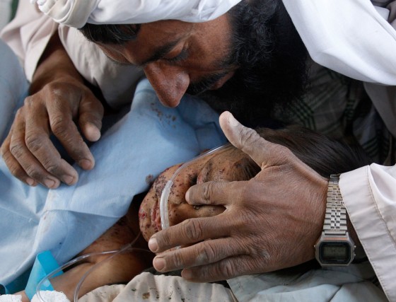 Image: A child injured by an explosion in Afghanistan's Helmand province