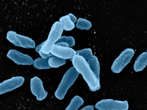 Scanning electron micrograph of the Ochrobactrum bacteria found in soil.