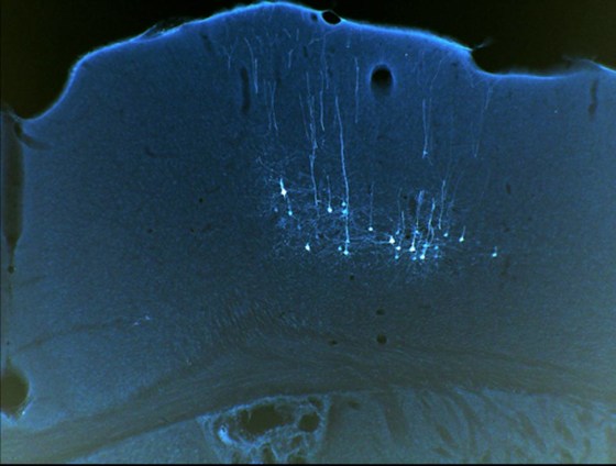 Image: Male mice motor cortext neurons