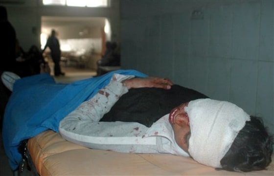 APTOPIX IRAQ VIOLENCE