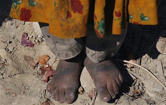 APTOPIX Afghanistan Cold