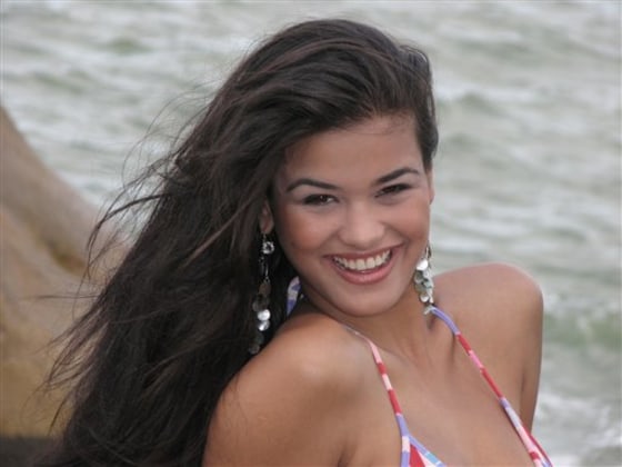 Brazil Model Amputation