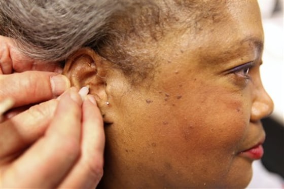 Military Acupuncture