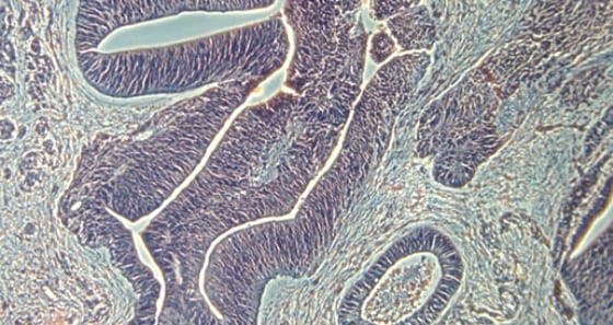 Image: photomicrograph of neural tissue derived from human skin cells