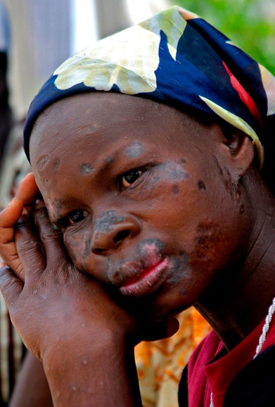 Image: Ivory Coast environmental pollution