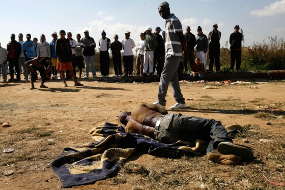 Image: man from Malawi lays wounded