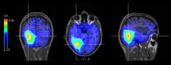 This computer-generated image shows an electrical response evoked in a subject's brain while looking at words flashed on a screen during an experiment.