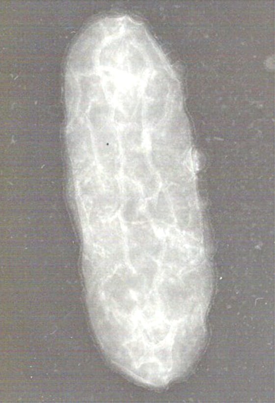 A micrograph shows Geobacter sulfurreducens, a bacterium that can consume uranium and apparently has genes for generating electricity.