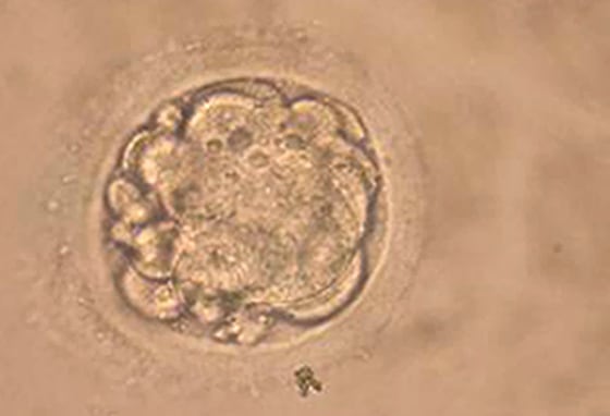 South Korean Researchers Clone Human Embryo