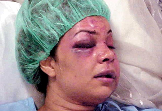 SAUDI-WOMEN-ABUSE-RANIA-AL BAZ