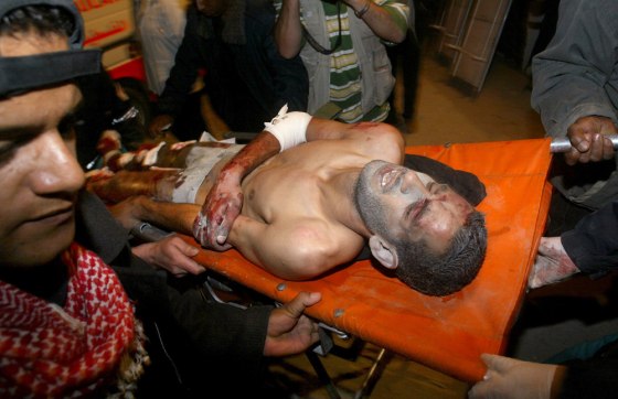 A Palestinian wounded Tuesday in an Israeli missile strike is rushed into Najar hospital in the Rafah refugee camp, southern Gaza Strip.