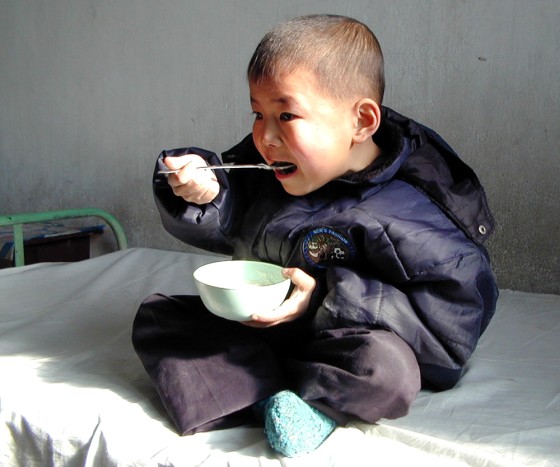 A MALNOURISHED NORTH KOREAN BOY