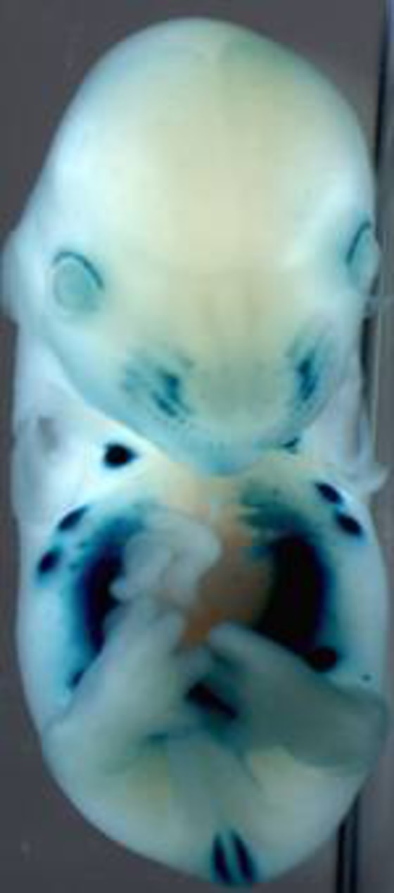 Scientists worked with genetically engineered mouse embryos to see whether the deletion of "junk DNA" sequences affected the activation of genes in specific tissues. This photo shows that the tissues (marked in blue) were largely unaffected.