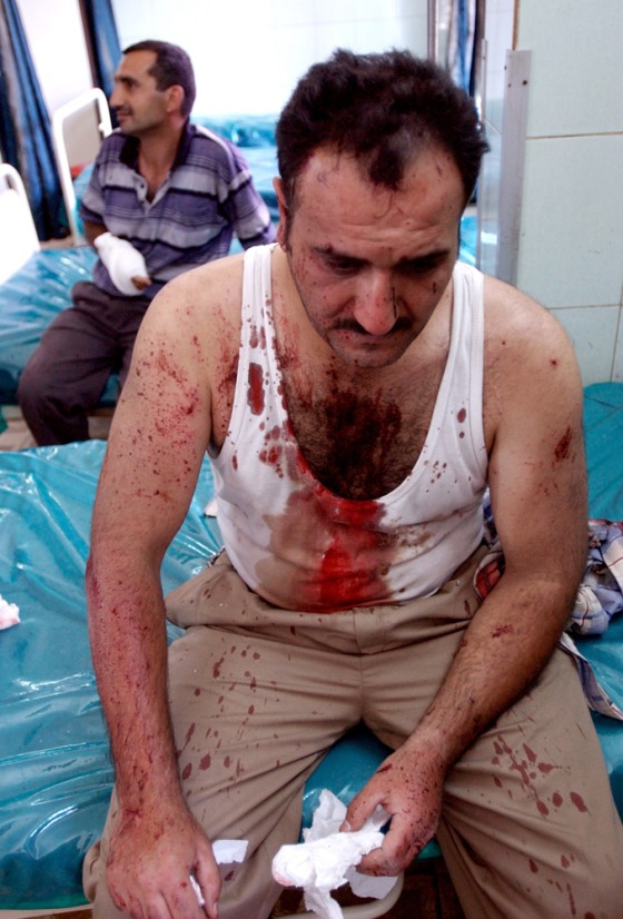 Baghdad airport employee Munef Badr sits at Yarmouk hospital Wednesday after being wounded by a suicide bombing near the airport's main checkpoint.