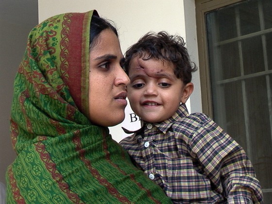 Zoya Zahoor, 3, smiles as she is held by her mother, Saida Nousrad. She is recovering from the head injury she received when debris fell on her during Pakistan’s Oct. 8 earthquake.