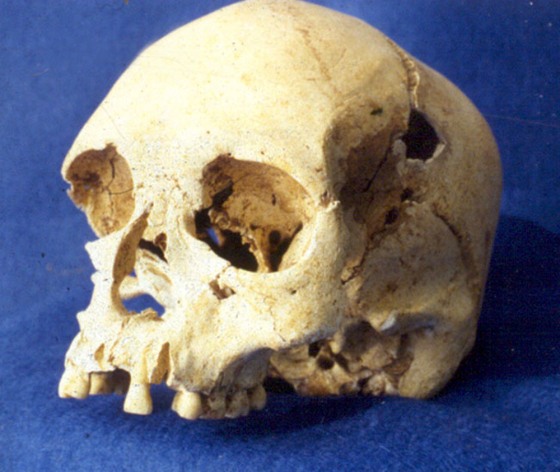 This skull of a Paleo-Indian woman, named “Luzia,” dates back to between 11,000 and 11,500 years ago.