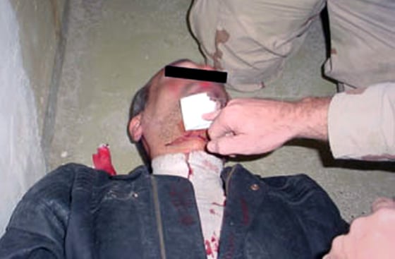 Image made available by Australia's SBS shows what the broadcaster says is an abused Detainee in Iraq's Abu Ghraib prison