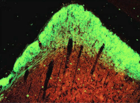 A photomicrograph shows a section of hamster brain treated with the synthetic nanofiber scaffold. The growth of new axons and nerves is shown in green.