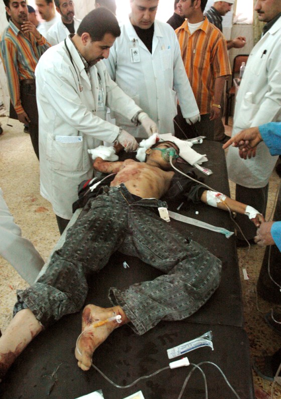 Doctors treat an injured Shiite boy who was wounded by a roadside bomb blast in Baghdad on Saturday. The boy was traveling to Karbala to take part in a religious ceremony.