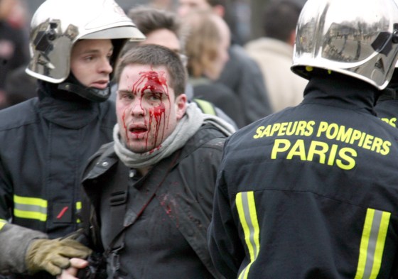 Injured demonstrator is carried away by firemen during clashes at the end of a protest march in Paris