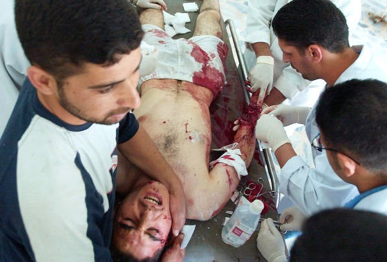 A man injured in a drive-by shooting is treated at a hospital on Wednesday in Khalis, north of Baghdad.
