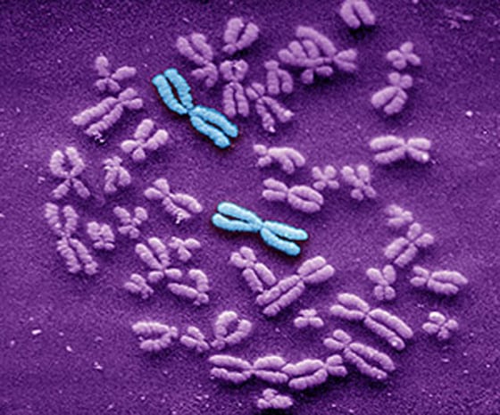 False-color photograph shows human chromosomes, with the Chromosome 1 pair highlighted in blue.