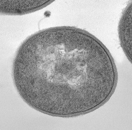 Undated microscopic image shows a bacteriophage absorbed at the surface of a bacterium