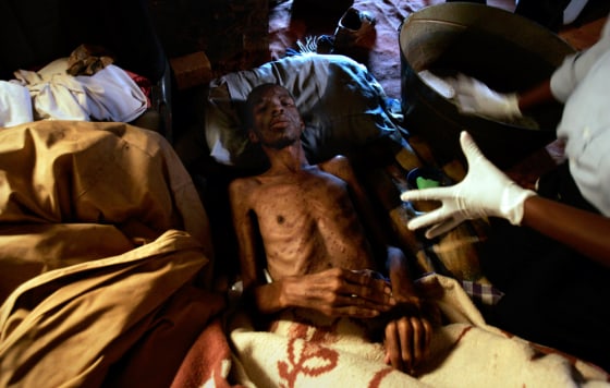 Simon Nkutwa is been given a bath in his shack at Orangefarm outside Johanneburg