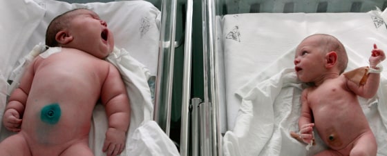 Baby girl Nadia, who weighed 7.75 kg (17.1 lbs) after birth, lies in a maternity ward in the Siberian city of Barnaul
