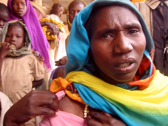 A woman who was raped by the Janjaweed militia shows her scars. Many women along the border have been raped and beaten by Arab militia.