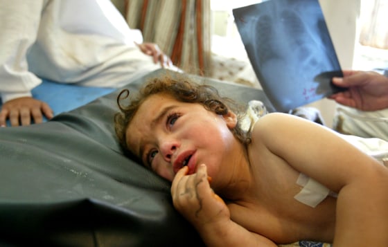 Kholood, a 2-year-old Iraqi girl, lies in a bed Sunday in the hospital in Ramadi, west of Baghdad, Iraq. Kholood was injured by shrapnel in her back when U.S. helicopters fired on a wedding party on May 19 in the desert near the border with Syria, killing more than 40 people. Kholood lost her parents, and four of her brothers and sisters during the attack. 