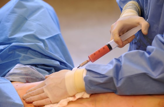 Image: Surgeon performs cosmetic surgery on a patient