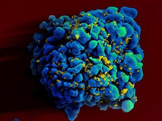 HIV-infected H9 T cell