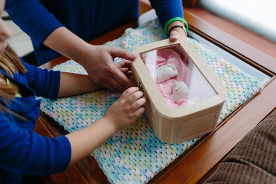 Image: A cast of Sophia's hand and foot