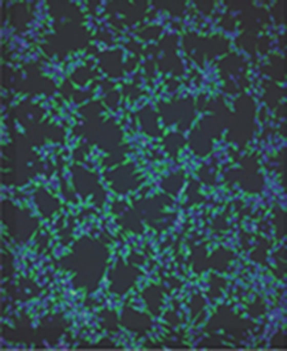 Image: Cells, grown from skin cells taken from people with bipolar disorder, which arose from stem cells and were coaxed to become neural progenitor cells